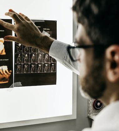 A doctor reviewing scan images